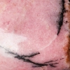 Rhodonite